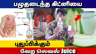 பழுதடைந்த கிட்னியை புதுப்பிக்கும் வேற லெவல் Juice  Yogam Vloggers [upl. by Ahtelat]