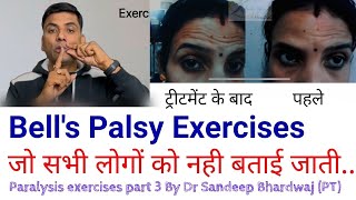 Bell’s palsy exercises आधे चेहरे का लकवा  Facial paralysis exercise Drsandeepbhardwaj [upl. by Iviv739]