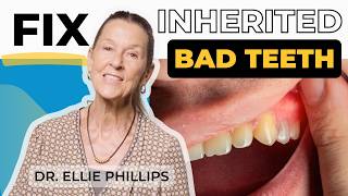 Inherited Bad Teeth You Can Fix Them [upl. by Lucila]