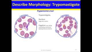 Trypanosoma Chagas disease and Sleeping sickness [upl. by Gawen]