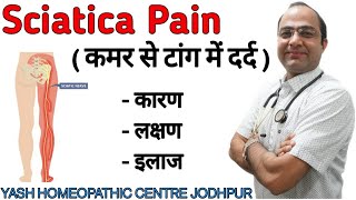 Sciatica  Hip thigh leg  nerve pain ।Cause symptoms । Best homeopathic treatment [upl. by Esertak486]