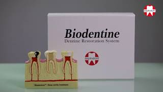 Biodentine mixing instructions [upl. by Notkcorb925]