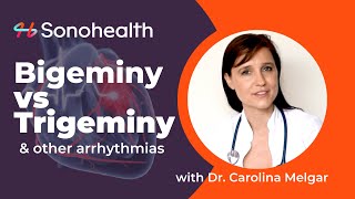 Bigeminy vs Trigeminy  PVCs amp Arrhythmias [upl. by Estren733]