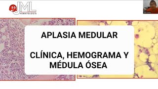 APLASIA MEDULAR APRENDIZAJE BASADO EN CASO CLÍNICOmedicina hematologia [upl. by Seel790]