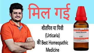 1 Best Homeopathic Medicine for Urticaria  हमेशा के लिए शीतपित्त या पित्ती का अंत सिर्फ एक दवा से [upl. by Aissatsana194]