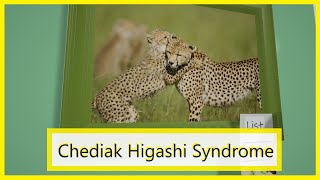 ChediakHigashi Syndrome Mnemonic for the USMLE [upl. by Nnailuj]