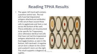 TPHA TestPositive [upl. by Couchman2]