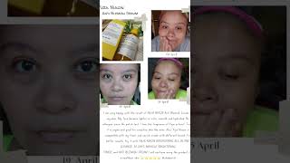 Kskincare YUJA NIACIN Anti Blemish Serum  Product Review [upl. by Leese]