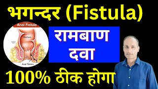 Fistula Ka Best Treatment Kya Hai  Best Homeopathic Medicine For Fistula with Loose motion [upl. by Alamac]