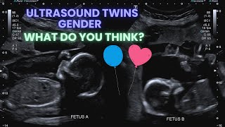 Ultrasound Pregnancy Twins Gender Identification Special interaction between the twins ❤️ [upl. by Aynotan]