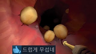 대장내시경하는 의사가 되어보는 공포게임 [upl. by Elsa]