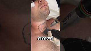 How Exactly Does Laser Tattoo Removal Actually Work 😳 [upl. by Hyacinthia]