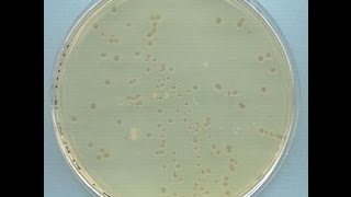 Preparation of Competent Cells Using Calcium Chloride  Amrita University [upl. by Eelyah]