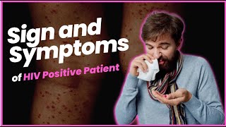 Sign and Symptoms of HIV Positive Patient [upl. by Kcirdla39]