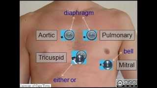 AUSCULTATION OF HEART SOUNDS [upl. by Coltson]