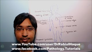 Turner Syndrome  Part 2 HD [upl. by Cassil]