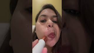 Upper Lip Hair Removal youtubeshorts youtube youtuber skincare facialhairs pcod nature [upl. by Jakoba]