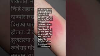 नेक्रोबायोसिस लिपोइडिका कंडिशन Necrobiosis Lipoidica health diabetes disease healthytips short [upl. by Livingstone]