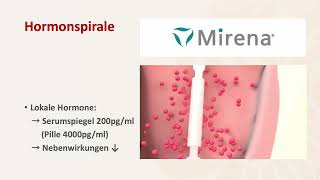 Hormonspirale MIRENAÂ® Liegezeit max 8 Jahre [upl. by Laehpar]