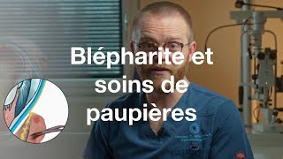 Blépharite et soins des paupières  COF [upl. by Malinowski]