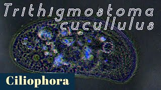 A cyrtophorid ciliate Trithigmostoma cucullulus Ciliophora [upl. by Norga]