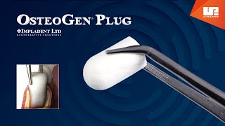 OsteoGen® Plug  One step bone grafting solution [upl. by Schertz]