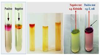 Bacterial Indole Test [upl. by Linn]