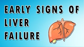 Symptoms of Liver Failure [upl. by Aynekat]