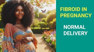 Fibroid in pregnancy  Normal delivery or CS  My pregnancy Journey [upl. by Idnahc]