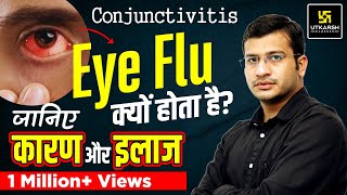 Eye Flu  Conjunctivitis यानी Eye Flu क्यों होता है Cause Prevention amp Treatment By Siddharth Sir [upl. by Naujed733]