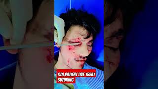 LIVE suturing  RTA WITH HEAD Injury shorts [upl. by Sufur]