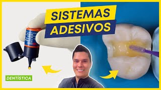 PRINCIPAIS SISTEMAS ADESIVOS EM ODONTOLOGIA  DENTÍSTICA [upl. by Nesyla718]