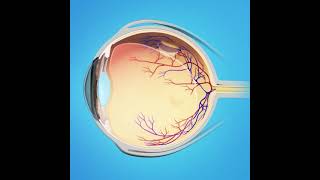 ¿Sabes qué es la Fotocoagulación Láser de Retina Procedimiento Desprendimiento de retina  Vidavas [upl. by Timmie271]