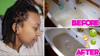 ACV Rinse on Locs  GROSS RESULTS 🤢😷Remove buildup with Apple Cider Vinegar [upl. by Schonthal643]