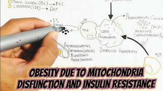 Obesity Due To Mitochondria Disfunction And Insulin Resistance Interplayobesity [upl. by Elyssa]