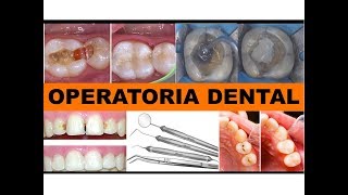 quotOPERATORIA DENTALquot por la Dra Lourdes Mejía 2 [upl. by Edlihtam]