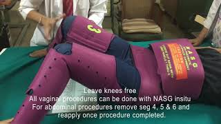 NASG The lifewrap in obstetric hemorrhage [upl. by Eibrik]