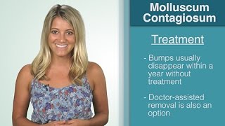 What Is  Molluscum Contagiosum [upl. by Rinna]