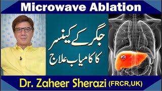 Liver Cancer Treatment in Lahore  Dr Zaheer Sherazi Explains Microwave Ablation [upl. by Morna159]