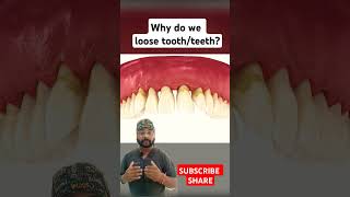 Why do we loose teeth Periodontitis explained yt short shortsfeed 3d animation dentistasmr [upl. by Schoenberg]