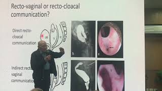 Radiological interpretation of cloacal MRI images by professor Alberto penia [upl. by Chemar]