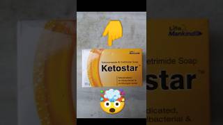 Ketostar Soap Uses amp Benefits  Best Soap for Dandruff amp Skin Care  Ketostar Soap Review [upl. by Nodarb375]