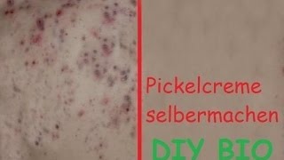 BIO Anti Pickel Creme selber machen  DIY naturelle Akne Salbe  Paste  Anleitung [upl. by Miarfe]