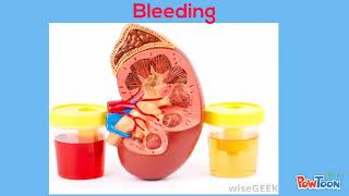 Kidney Biopsy Informational Video [upl. by Miett]