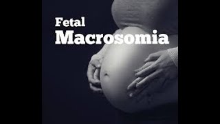 Fetal Macrosomia [upl. by Shanahan]