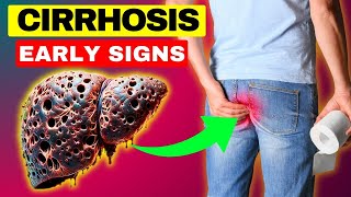 12 weird signs of liver damage  Liver CIRRHOSIS  Liver DETOX with Just 3 Remedies  HealthQuest [upl. by Ethelinda149]