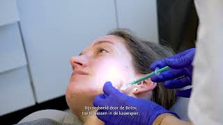 TREATMENT Confidence Booster® COLLAGEN amp Botox behandeling [upl. by Northrop99]