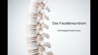 Facettensyndrom 2 Übungen gegen Rückenschmerzen [upl. by Symer]