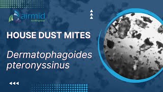 House Dust Mites  under the microscope at airmid healthgroup [upl. by Raimondo]