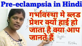 Preeclampsia lecture in hindi  प्रीएक्लेम्पसिया  Types amp causes  Hypertensionprotienureaoedema [upl. by Marnia]